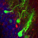 Image for article titled Transplanted Brain Cells Can Outlast The Body's Biological Clock